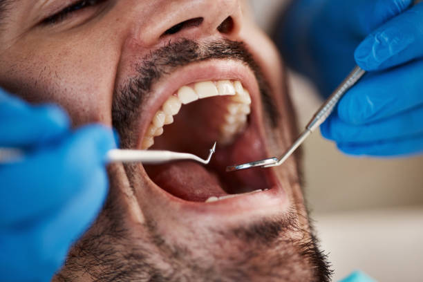 Best Emergency Cosmetic Dentistry (e.g., broken veneers) in Delhi Hills, OH